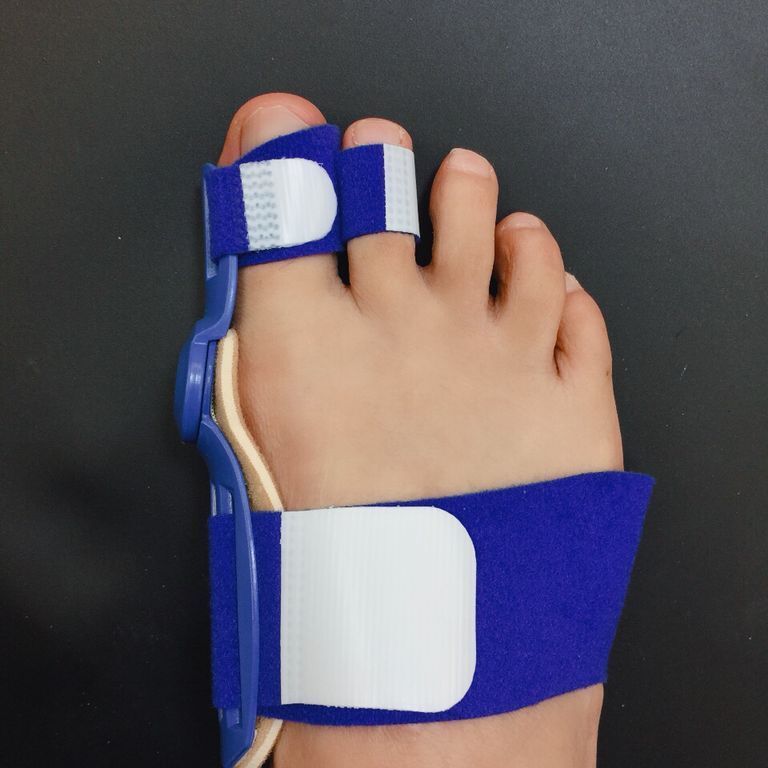 Big Foot Hallux Valgus Corrector – Justerbart Hallux Valgus-skydd och stortåstöd för smärtlindring, dag och natt